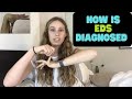 How to Get Diagnosed With EDS | 2017 EDS Criteria