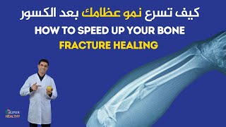 10 اسرار لتسريع علاج كسور العظام | Secrets for speedy bone healing