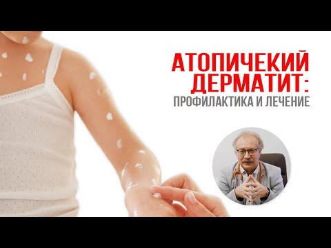 Атопический дерматит: профилактика и лечение