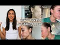 My Skincare Journey | What Didn’t Work - What Worked | Emotions & Treating Root Causes | Sami Clarke