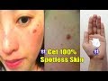 90% People Dont know This remedy to Remove dark spots black spots just Apply it just 5 mins Get fair