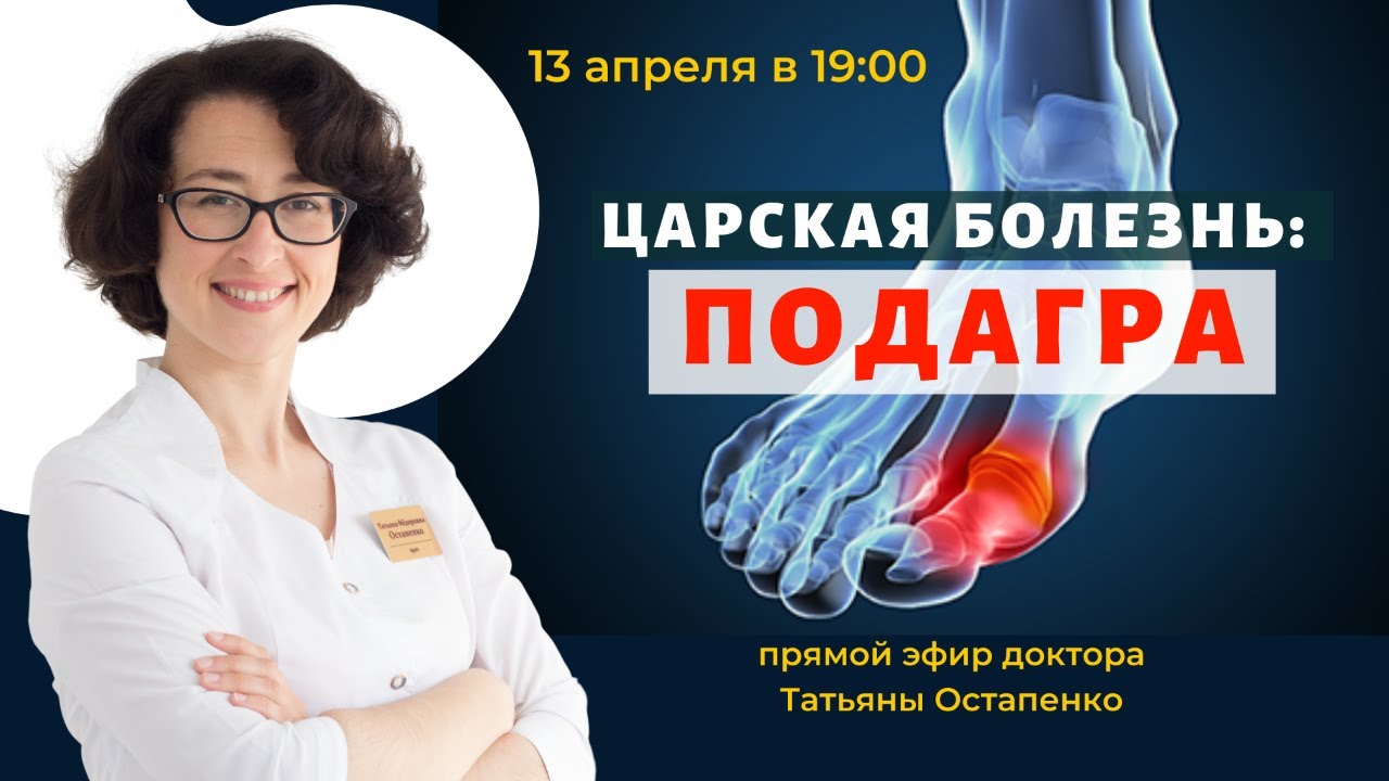 Царская болезнь: подагра. - YouTube