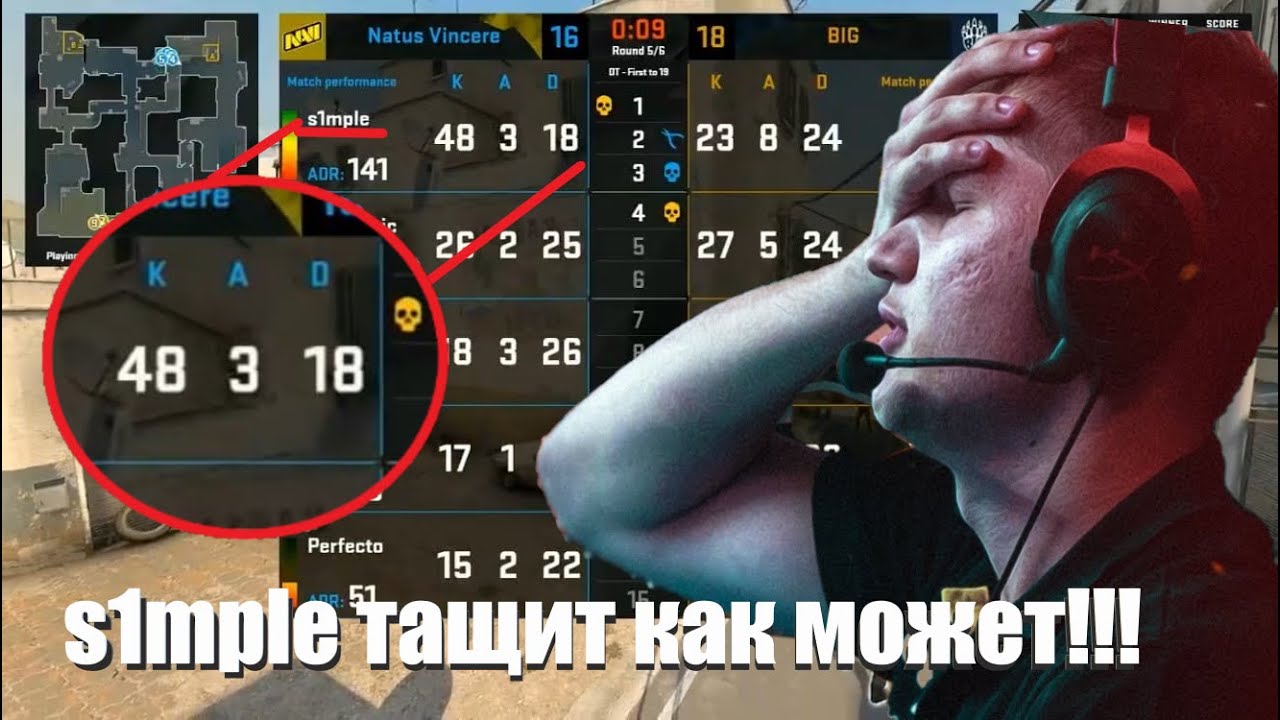 СИМПЛ ПЫТАЕТСЯ ТАЩИТЬ СВОЮ КОМАНДУ! Na’Vi VS BIG CS:GO @ESLPROLEGUE ЛУЧШИЕ МОМЕНТЫ МАТЧА