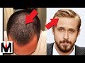 Is Thin Hair Bad For Guys