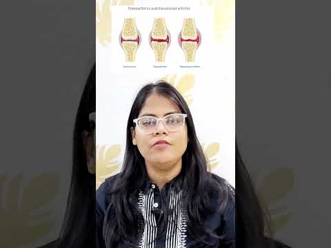 Osteoarthritis vs Rheumatoid arthritis | OA vs RA