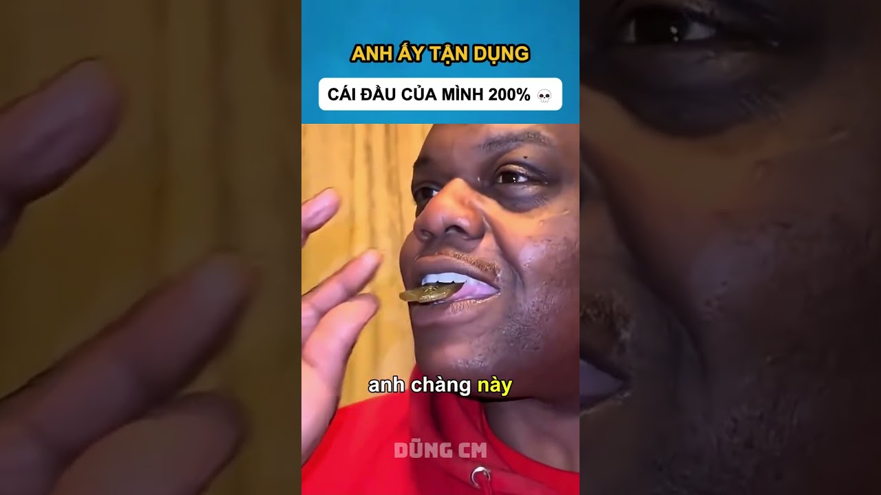 Cái Trán Này Nghiền Nát Mọi Thứ 😭