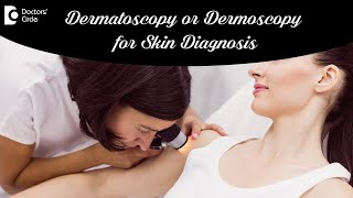 DERMOSCOPY /DERMATOSCOPY. How & Why is it done? Causes & Treatment-Dr.Aruna Prasad | Doctors