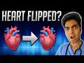 Doctor reacts: Heart on WRONG SIDE of the body?!