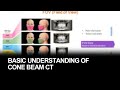 Basic understanding of cone beam CT