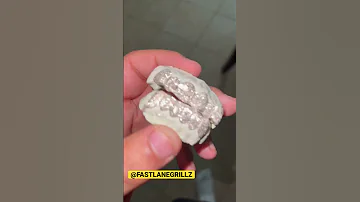 6 On 6 DIAMOND DUST GRILL From FASTLANEGRILLZ Jewelry Diamonddust Grillz 