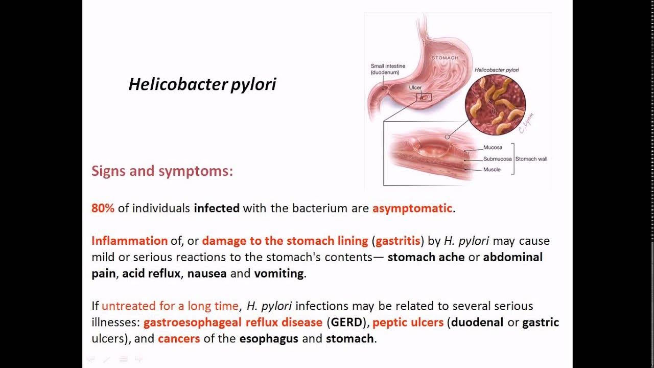 Menú para helicobacter pylori