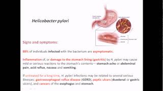 Helicobacter pylori signs and symptoms
