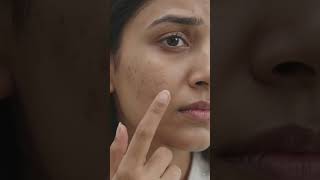 Skin Alive Product Vitamin c फैंस मॉस्क #my #faceserumforoilyskin #skincare