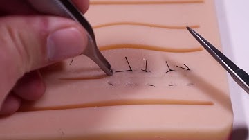 Horizontal Mattress Suture Technique