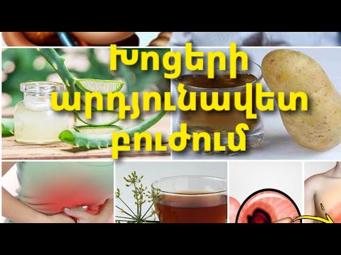 Video: Հաստ պատերով