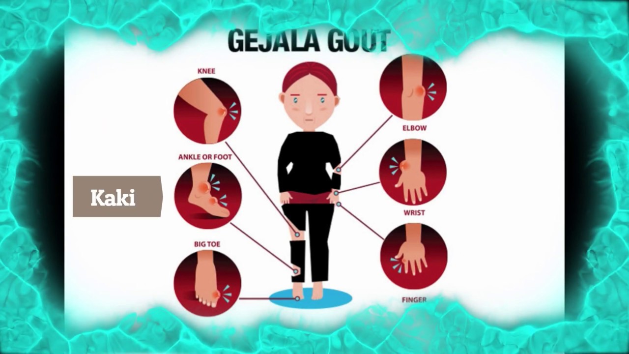 Rawatan Gout Dengan Menggunakan Kapsul Herba - YouTube