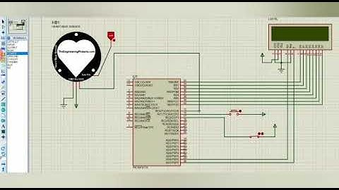 Heart beat monitoring using pulse sensor and pic
