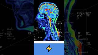 Brain Surgery Kaise Hoti Hai? 🧠 MRI, CT Scan & Brain Mapping 🔥 Explained | TV Health