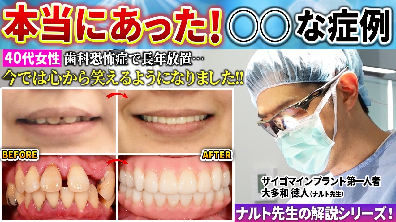 A true story of a 40-year-old woman whose teeth were so loose and