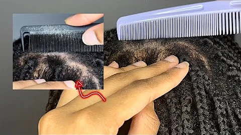 1 HR ASMR BRAIDS scratching, scalp inspection & white hair plucking!! | ASMReagan