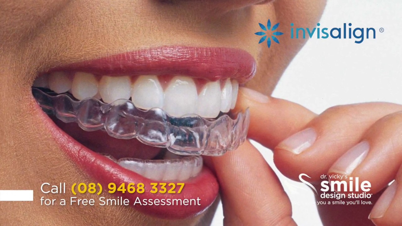 What is Invisalign? YouTube