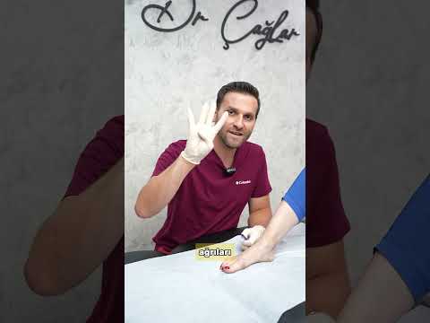 AYAK BİLEĞİNDE AĞRI VARSA… #sağlık #trending #shortvideo