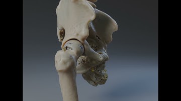 Cinematic Rendering Technology Demo