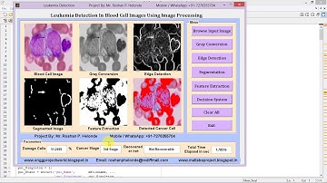 Leukemia Detection Using Image Processing Matlab Code IEEE Based Project