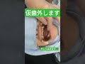 完成した仮歯を外して、はめました　大阪前歯セラミック矯正専門ダイヤモンド今井院長#仮歯#セラミック#セラミック矯正