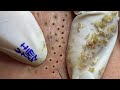 Satisfying with hien nguyen spa beauty 015