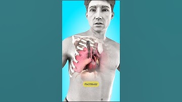What To Do If Your Lungs Got Punctured 😵‍💫
