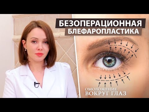 Видео: Безоперационная подтяжка глаз: что это такое и работает ли оно?