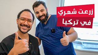 تجربتي في زراعة الشعر في تركيا