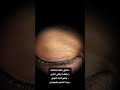 فوائد كحل الاثمد للعينين اشراق الاثمد