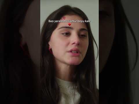 Bazı yaraların izi ömür boyu kalır 💔#sevdiğimsensin #aytaçşaşmaz #helinkandemir