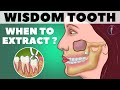 Wisdom Teeth Removal / When to extract Wisdom teeth (Third molar) / Animation // Medinaz