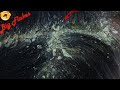 Extrem Dandruff | Hand Full Big Flakes Scratching On Scalp # 928