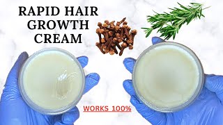 CLOVES &amp; ROSEMARY LEAVE IN HAIR POMADE: STOP HAIR LOSS, DANDRUFF &amp; DRYNESS