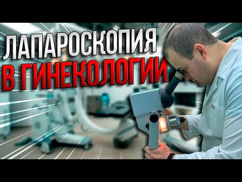 Лапароскопия в гинекологии: за и против. Оводенко Дмитрий Леонидович. Москва.