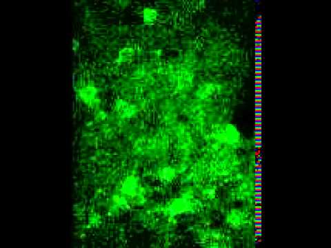 Video: Vliv Blízkosti Lézí Na Regenerační Odpověď Dlouho Sestupujících Propriospinálních Neuronů Po Poranění Páteře