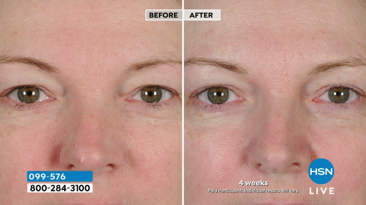 NassifMD PeriOrbital Eye Complex