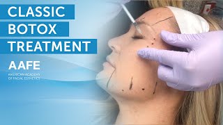 Full Face Botox Treatment | AAFE
