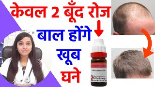 बालों का झड़ना कैसे रोके | balon ka girna kaise roke | wiesbaden homeopathy hair loss| balon ka tutna screenshot 3