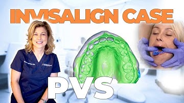 How To Take PVS Dental Impressions for Invisalign