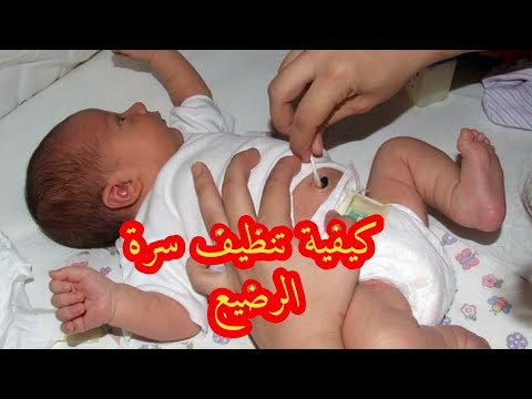 فيديو: كيفية تنظيف زر البطن: 10 خطوات (بالصور)