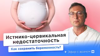 видео: Истмико-цервикальная недостаточность. Можно ли обойтись без пессария? картинка: Истмико-цервикальная недостаточность. Можно ли обойтись без пессария?