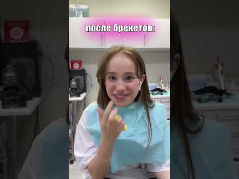 КАК МОЯ ЖИЗНЬ ИЗМЕНИЛАСЬ С БРЕКЕТАМИ #shorts #tiktok # a4 #брекеты