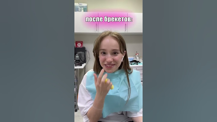 КАК МОЯ ЖИЗНЬ ИЗМЕНИЛАСЬ С БРЕКЕТАМИ #shorts #tiktok # a4 #брекеты