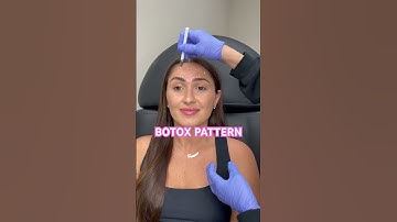 Botox marking pattern #botox101 #botoxmarking #botoxpatterns #botoxinjections #injections