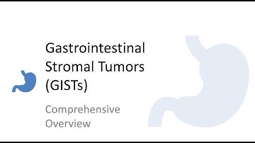 Comprehensive Overview of Gastrointestinal Stromal Tumors (GIST): Diagnosis, Treatment and Prognosis